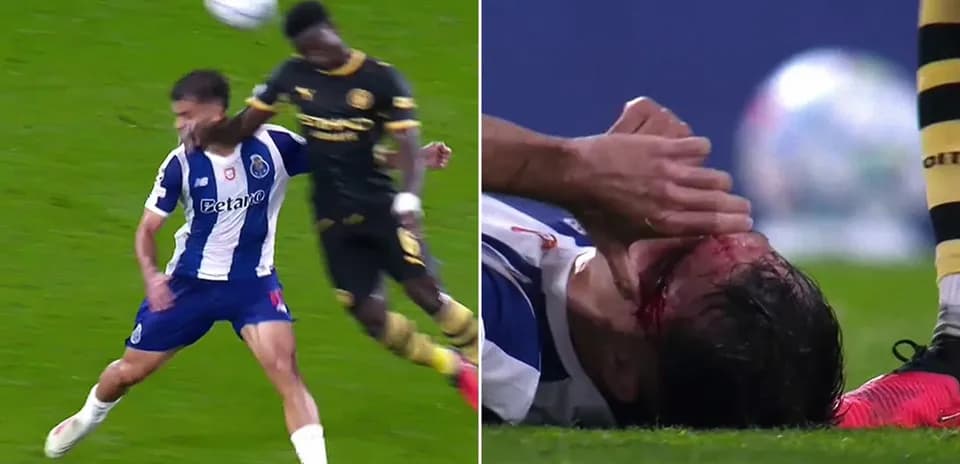 Joueur de Porto blessé au visage après un choc
