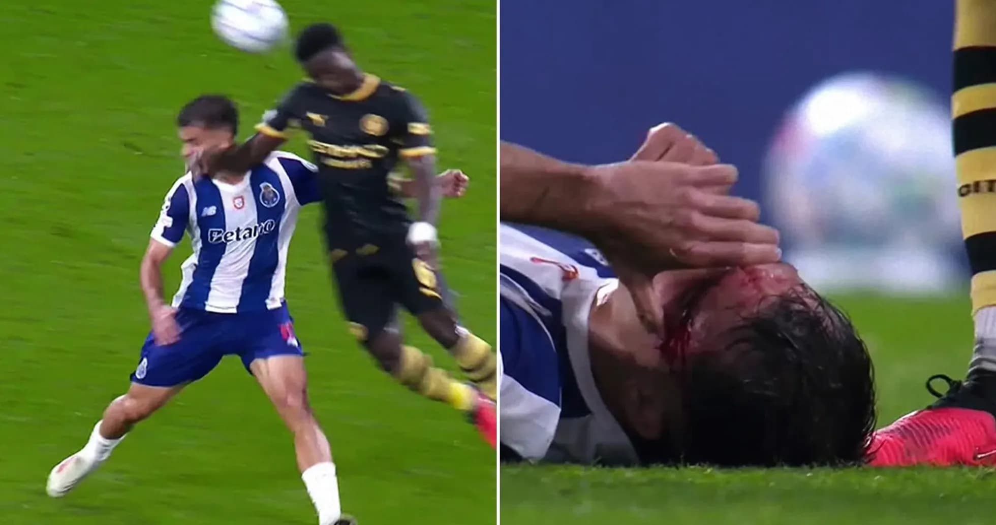 Joueur de Porto blessé au visage après un choc Joueur de Porto blessé au visage après un choc